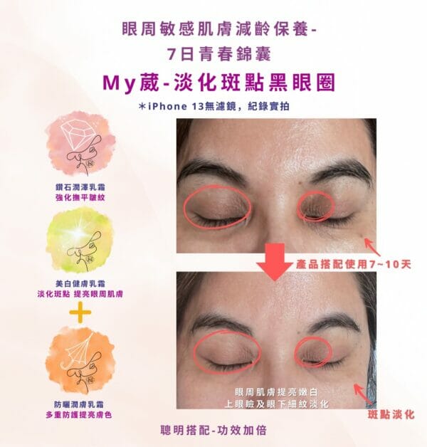 美白/抗皺/淡化斑點最佳保養品 美白健膚乳霜
